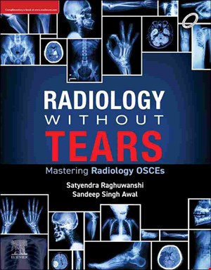 Radiology Without Tears, Mastering Radiology OSCEs